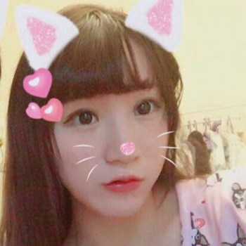 北京麗詩麗格楊明強玻尿酸豐唇半個月了，看看果~